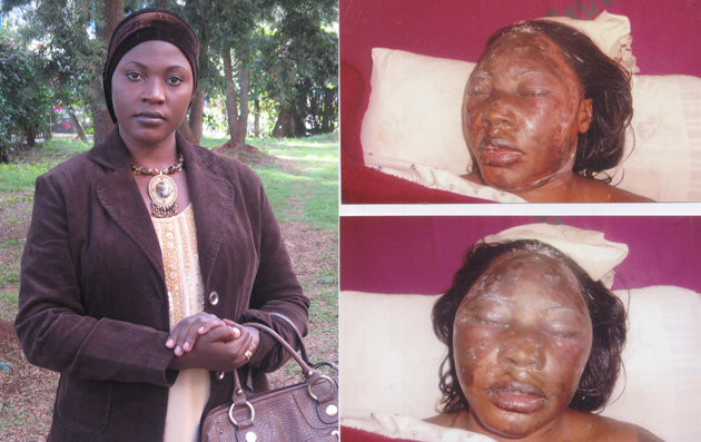 Yahoo News - Hanifa in 2009, left, before the attack and just 12 hours after, right. (2).jpg
