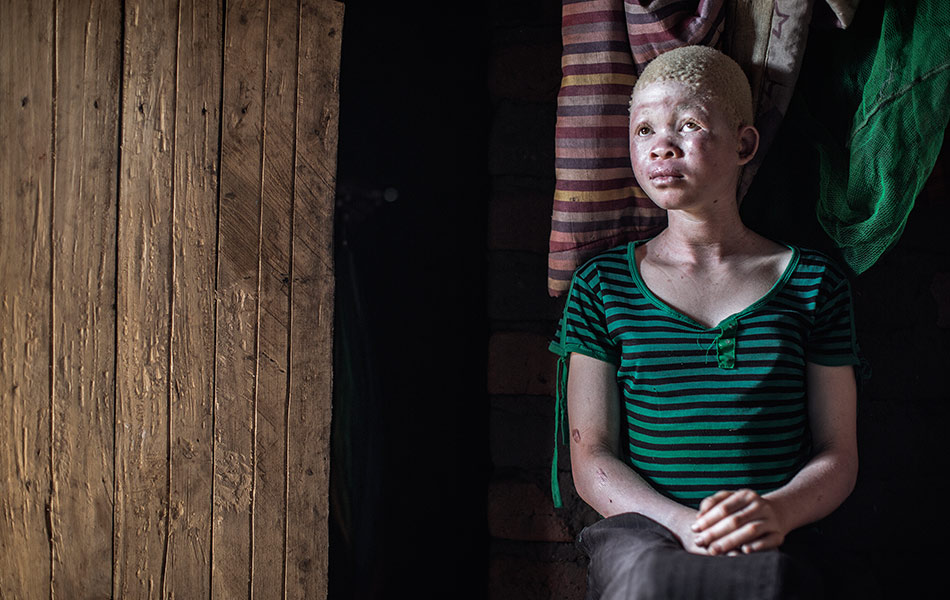 Albino4.jpg