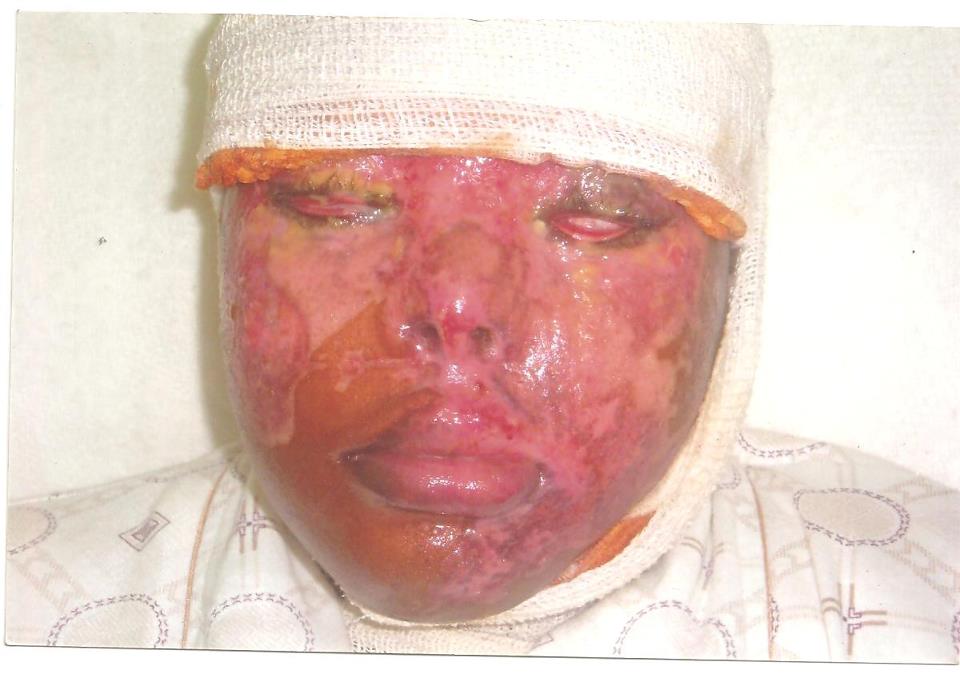 Hanifa in hospital.jpg