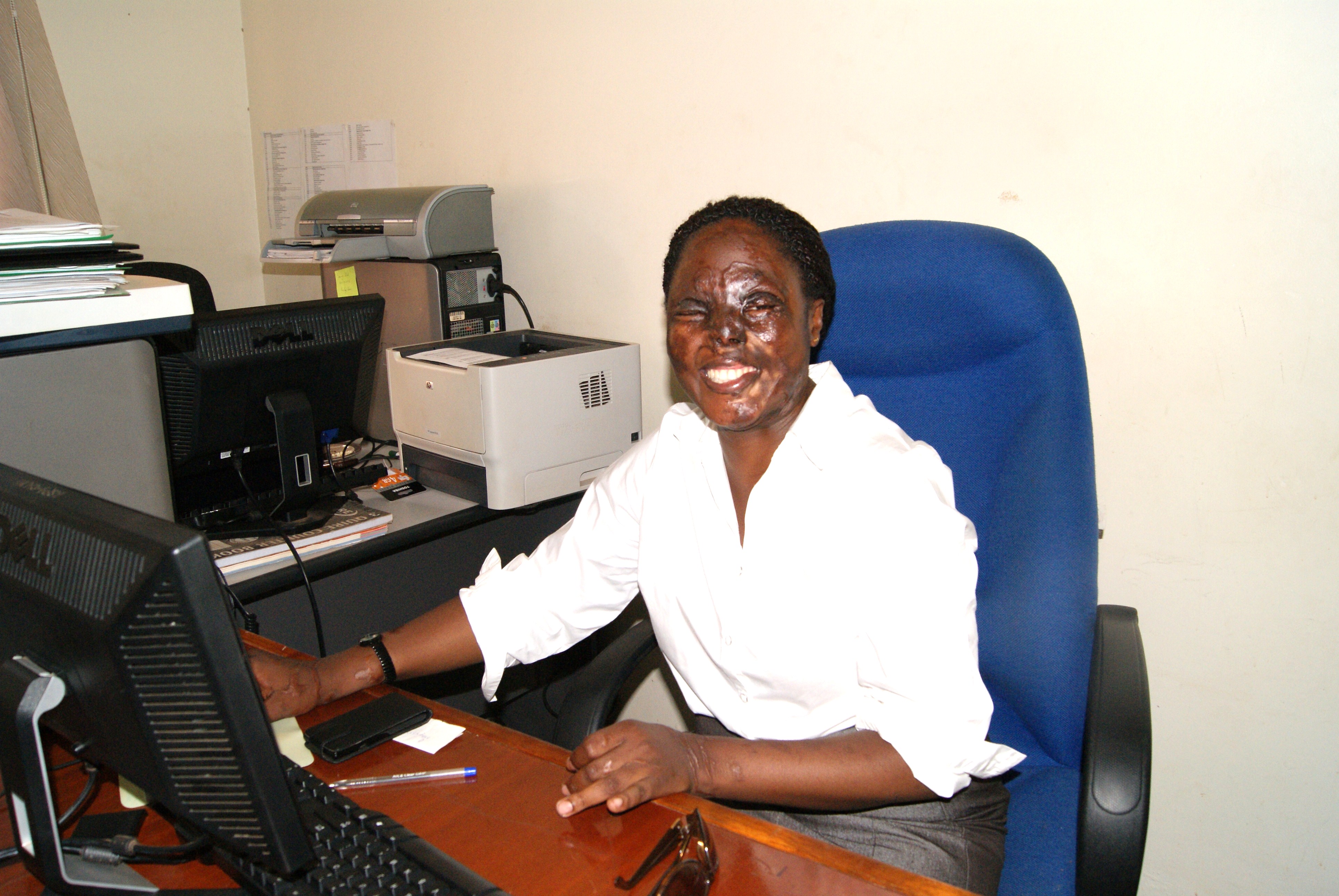Hanifa working for acid survivors.JPG
