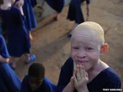 [image for World Spotlight Albinos1.png]